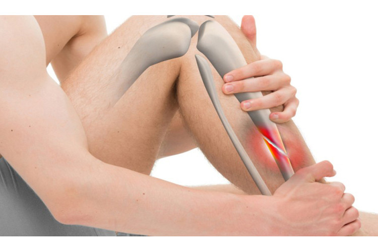 ПРАВИЛЬНИЙ ВИБІР ЗАСОБУ ДЛЯ ЗДОРОВ'Я СУГЛОБІВ 